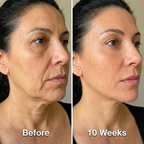 Rejuvenating Double V Mask